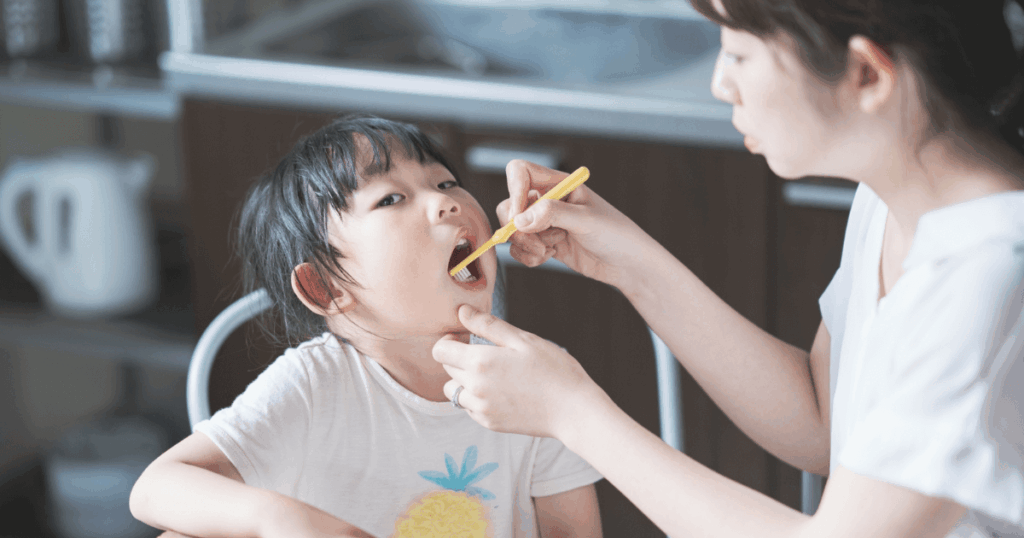 歯並びの乱れが虫歯や口腔トラブルにつながる可能性を示すイメージ